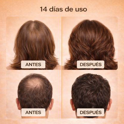 Champú profesional dellinston